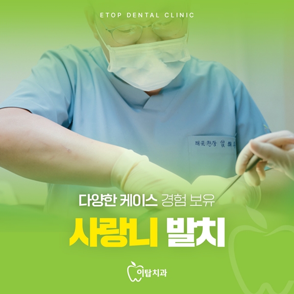 사랑니 다양한케이스보유